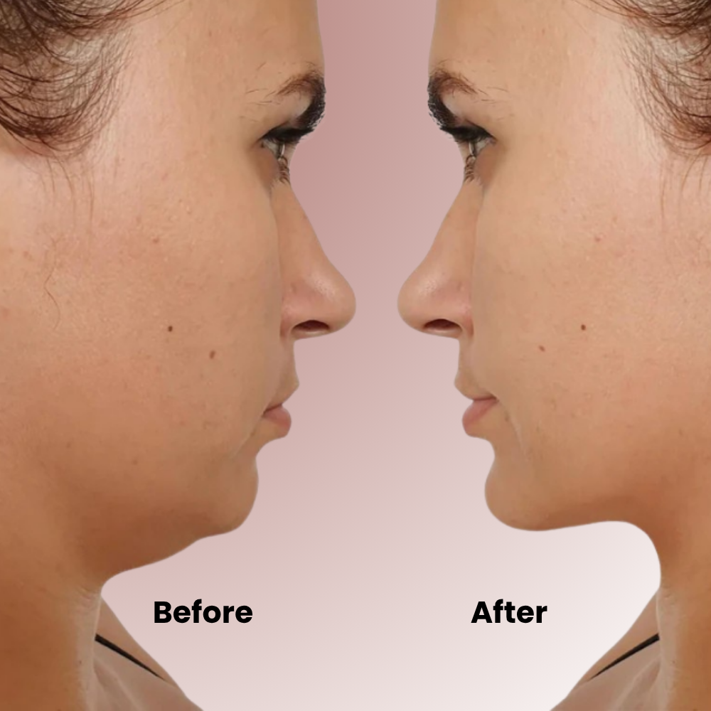 Sculptique™ Face Shaper